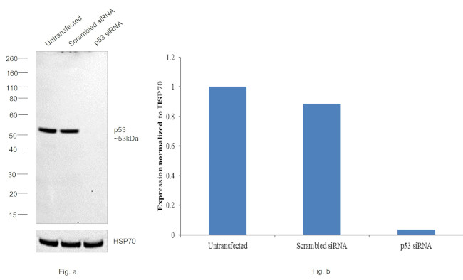 p53 Antibody in Western Blot (WB)