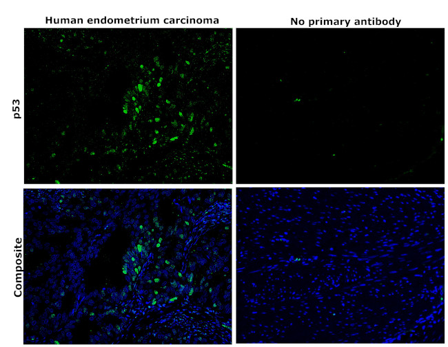 p53 Antibody in Immunohistochemistry (Paraffin) (IHC (P))