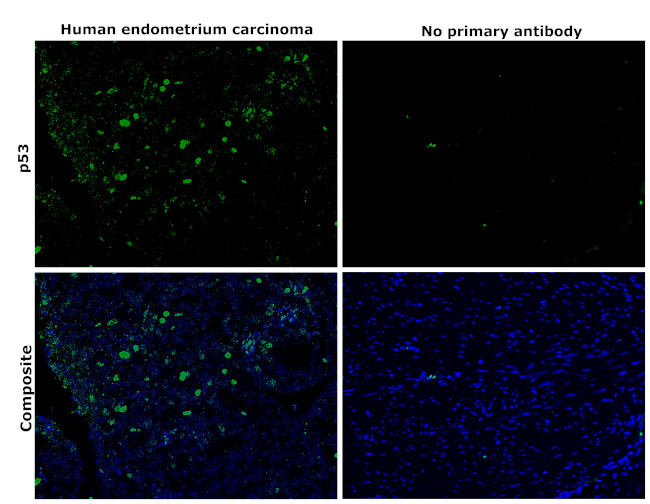 p53 Antibody in Immunohistochemistry (Paraffin) (IHC (P))