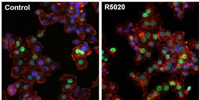 Progesterone Receptor Antibody