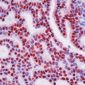 Progesterone Receptor Antibody in Immunohistochemistry (Paraffin) (IHC (P))