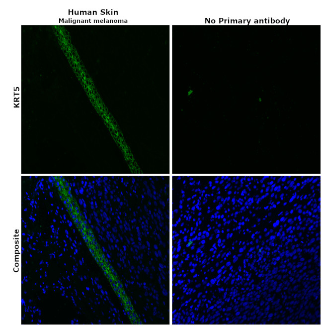 Cytokeratin 5 Antibody in Immunohistochemistry (Paraffin) (IHC (P))