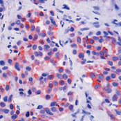 Cytokeratin 5 Antibody in Immunohistochemistry (Paraffin) (IHC (P))