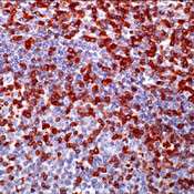 Zap-70 Antibody in Immunohistochemistry (Paraffin) (IHC (P))