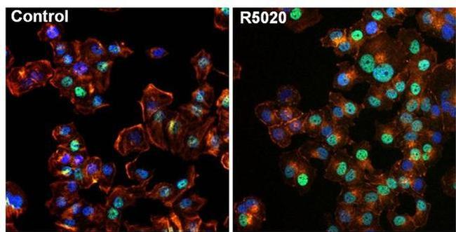 Progesterone Receptor Antibody