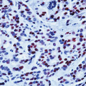 Progesterone Receptor Antibody in Immunohistochemistry (Paraffin) (IHC (P))