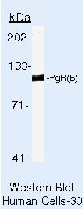 Progesterone Receptor Antibody in Western Blot (WB)