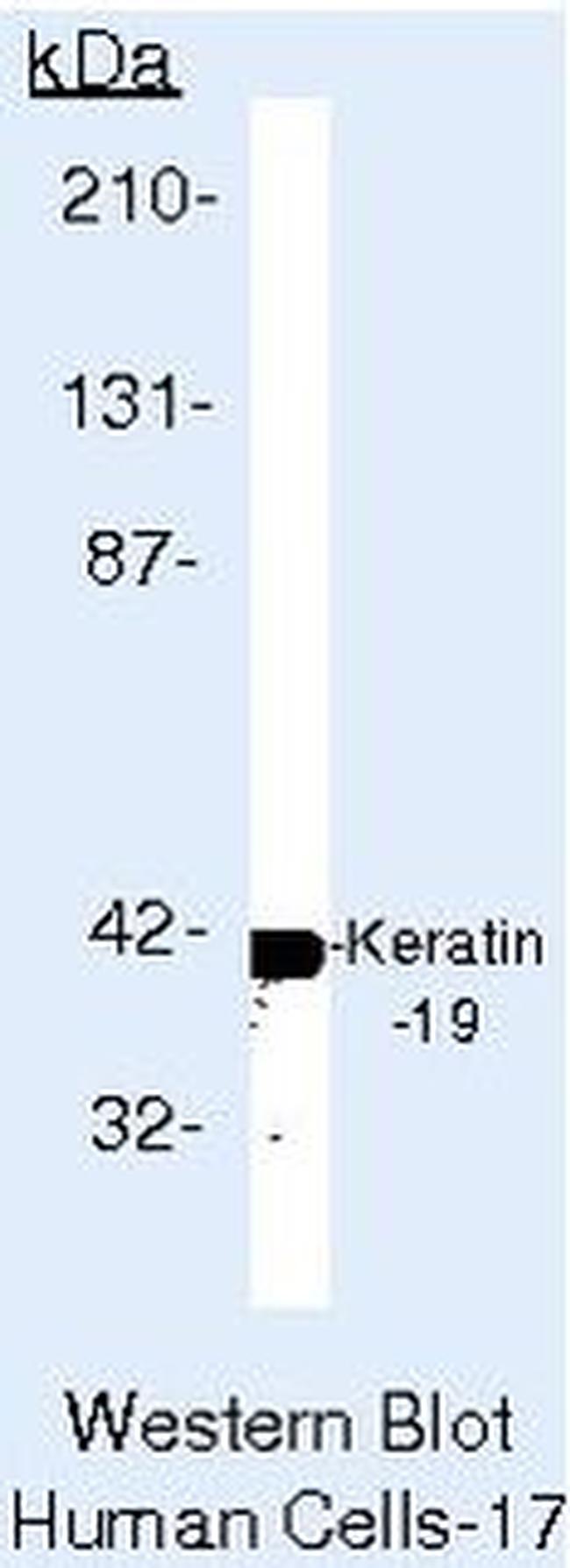 Cytokeratin 19 Antibody in Western Blot (WB)