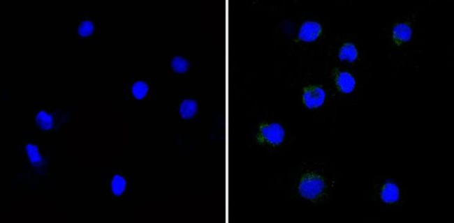 CD25 Antibody in Immunocytochemistry (ICC/IF)