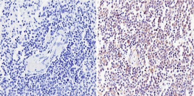 CD25 Antibody in Immunohistochemistry (Paraffin) (IHC (P))