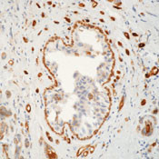 TGM2 Antibody in Immunohistochemistry (Paraffin) (IHC (P))