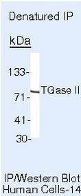 TGM2 Antibody in Immunoprecipitation (IP)