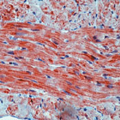 Prohibitin Antibody in Immunohistochemistry (Paraffin) (IHC (P))