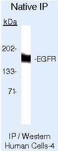 EGFR Antibody in Immunoprecipitation (IP)