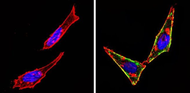 c-Kit Antibody in Immunocytochemistry (ICC/IF)