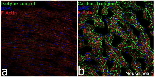 Cardiac Troponin T Antibody in Immunohistochemistry (Frozen) (IHC (F))