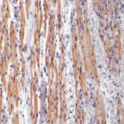 Cardiac Troponin T Antibody in Immunohistochemistry (Paraffin) (IHC (P))