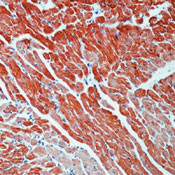 Cardiac Troponin T Antibody in Immunohistochemistry (Paraffin) (IHC (P))