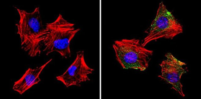 S100 Antibody in Immunocytochemistry (ICC/IF)