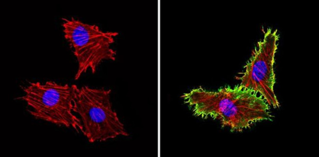 ICAM-1 Antibody in Immunocytochemistry (ICC/IF)