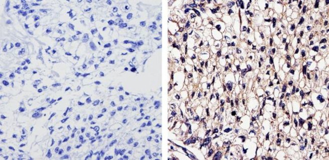 EGFR Antibody in Immunohistochemistry (Paraffin) (IHC (P))