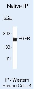 EGFR Antibody in Immunoprecipitation (IP)