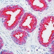 Prostate Specific Acid Phosphatase Antibody in Immunohistochemistry (Paraffin) (IHC (P))