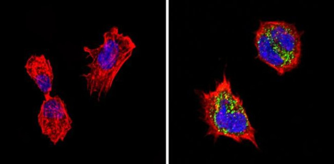 Chromogranin A Antibody in Immunocytochemistry (ICC/IF)