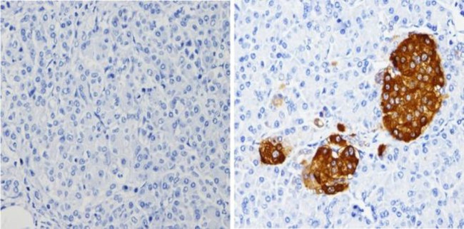 Chromogranin A Antibody in Immunohistochemistry (Paraffin) (IHC (P))