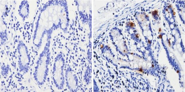 Chromogranin A Antibody in Immunohistochemistry (Paraffin) (IHC (P))