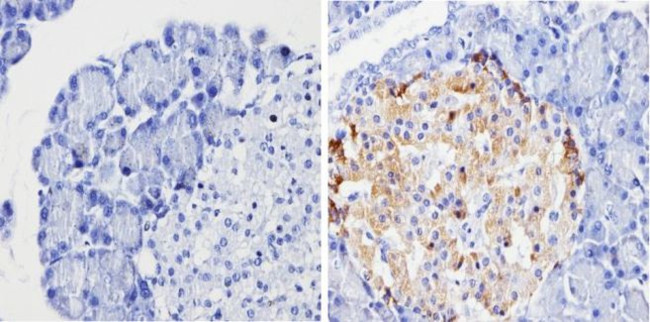 Chromogranin A Antibody in Immunohistochemistry (Paraffin) (IHC (P))