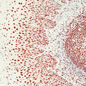 Ku70 Antibody in Immunohistochemistry (IHC)