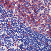 CD35 Antibody in Immunohistochemistry (Paraffin) (IHC (P))