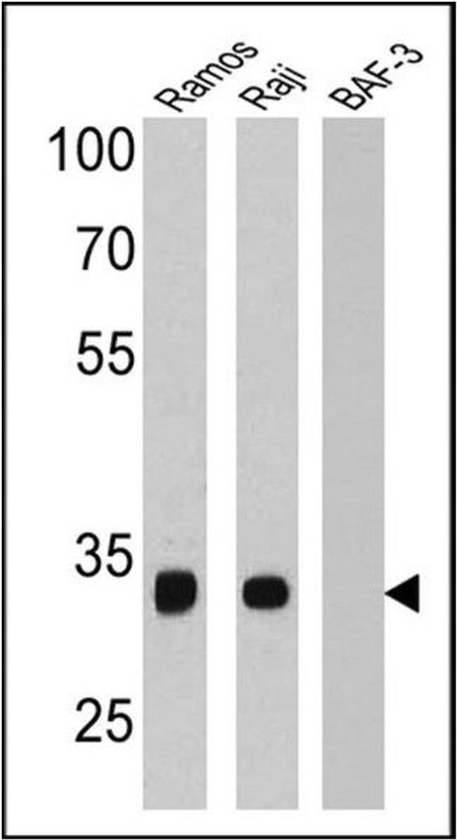 CD20 Antibody in Western Blot (WB)