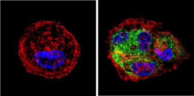 Cytokeratin Pan Type I Antibody in Immunocytochemistry (ICC/IF)