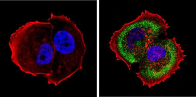 Cytokeratin Pan Type I Antibody in Immunocytochemistry (ICC/IF)