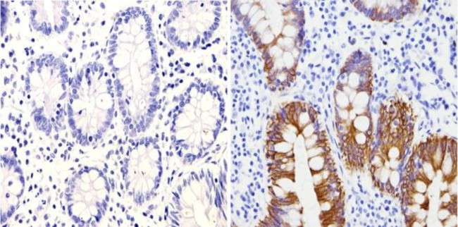 Cytokeratin Pan Type I Antibody in Immunohistochemistry (Paraffin) (IHC (P))