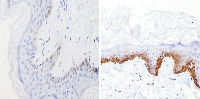 Cytokeratin Pan Type I Antibody in Immunohistochemistry (Paraffin) (IHC (P))