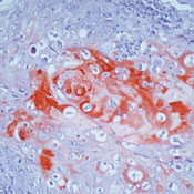 Cytokeratin Pan Type I Antibody in Immunohistochemistry (Paraffin) (IHC (P))