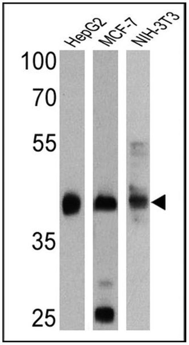 Cytokeratin Pan Type I Antibody in Western Blot (WB)