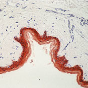 Cytokeratin Pan Type II Antibody in Immunohistochemistry (Paraffin) (IHC (P))