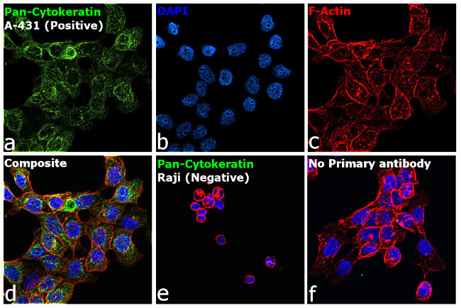 Cytokeratin Pan Type I/II Antibody in Immunocytochemistry (ICC/IF)