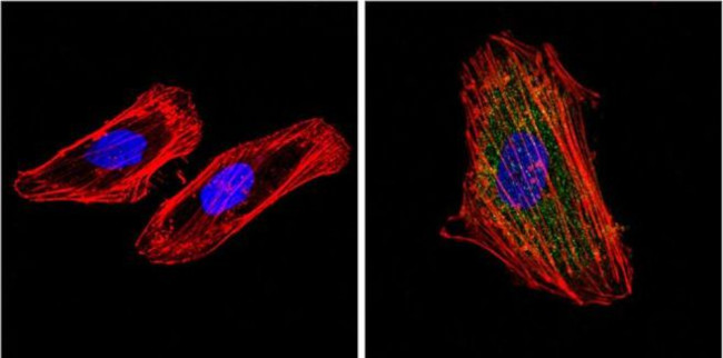 Cytokeratin Pan Type I/II Antibody in Immunocytochemistry (ICC/IF)