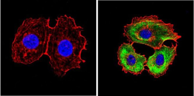 Cytokeratin Pan Type I/II Antibody in Immunocytochemistry (ICC/IF)