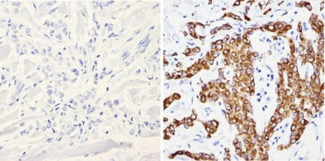 Cytokeratin Pan Type I/II Antibody in Immunohistochemistry (Paraffin) (IHC (P))