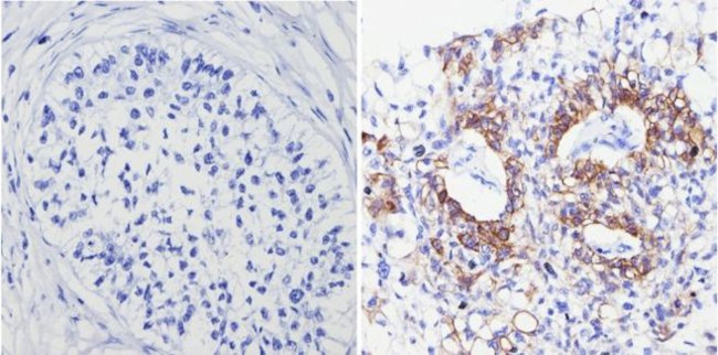 Cytokeratin Pan Type I/II Antibody in Immunohistochemistry (Paraffin) (IHC (P))