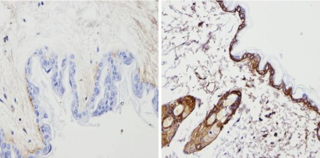 Cytokeratin Pan Type I/II Antibody in Immunohistochemistry (Paraffin) (IHC (P))