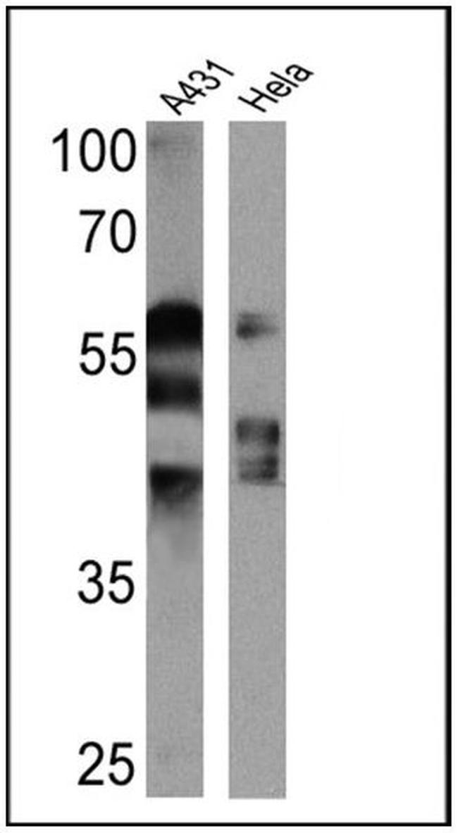 Cytokeratin Pan Type I/II Antibody in Western Blot (WB)