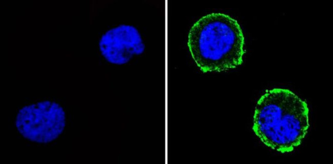 CD31 Antibody in Immunocytochemistry (ICC/IF)