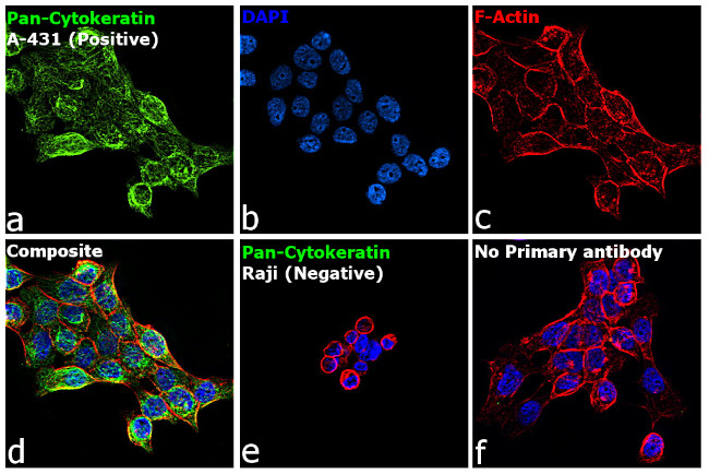 Cytokeratin Pan Antibody